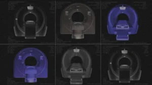 Рентген абсурду: як сотні мільйонів бюджетних гривень перетворилися на «мертві» томографи