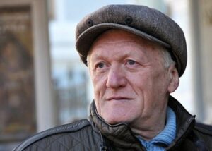 Відомий продюсер розповів про невдалі косметологічні процедури